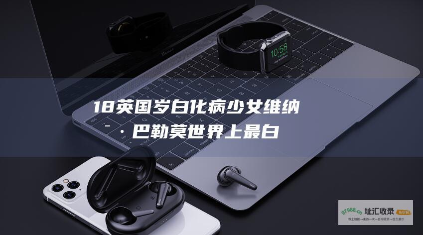 18英国岁白化病少女维纳斯·巴勒莫世界上最白